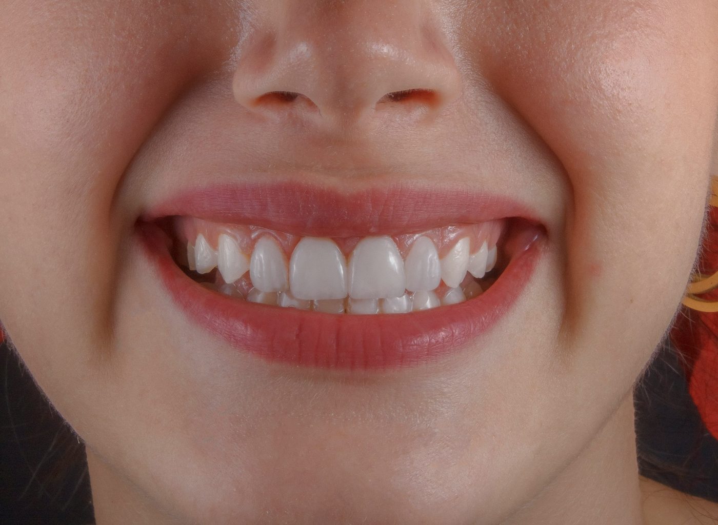 Sourire aux dents blanches