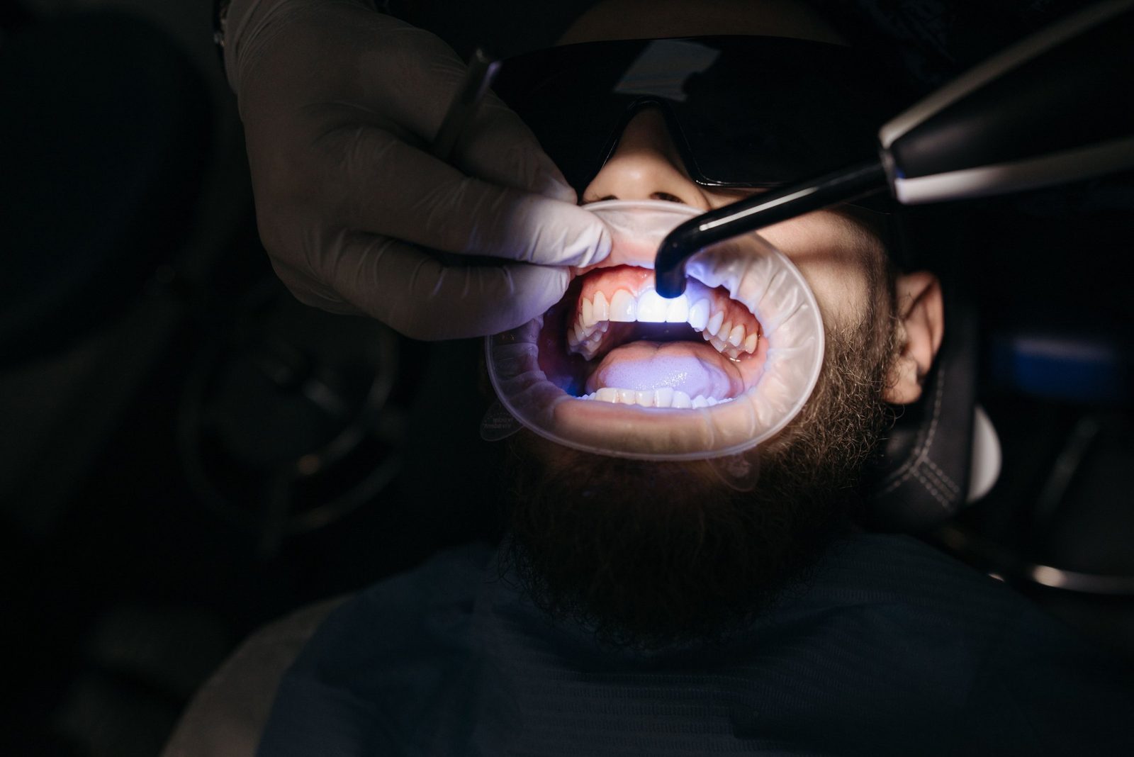 Dentisterie restauratrice au cabinet dental eden